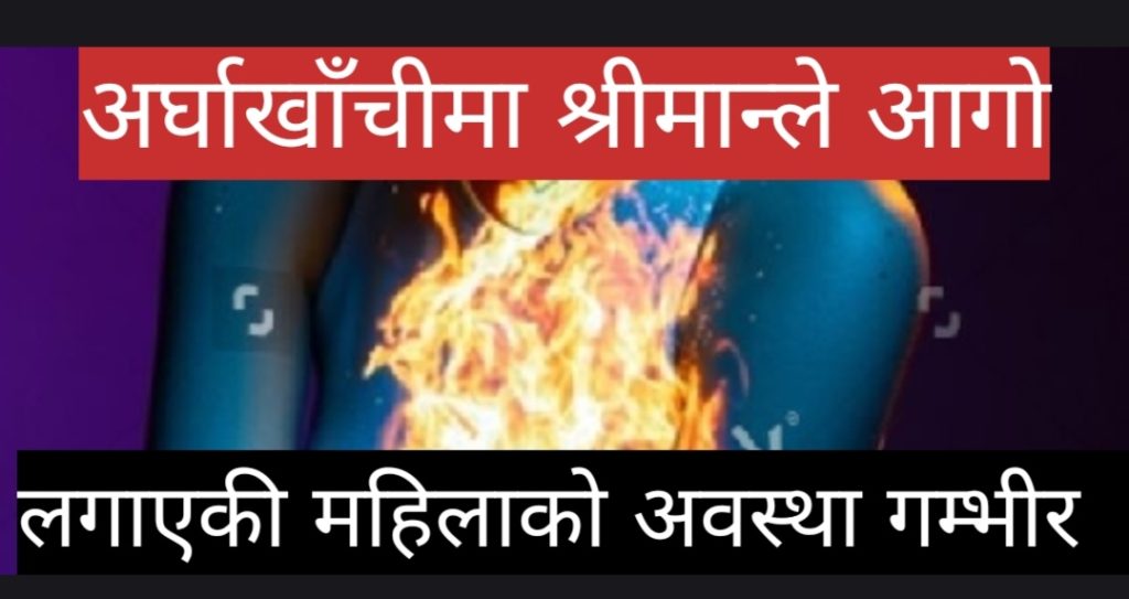 अर्घाखाँचीमा श्रीमान्ले आगो लगाएकी महिलाको अवस्था गम्भीर, थप उपचारका लागि काठमाडौँ पठाइयो